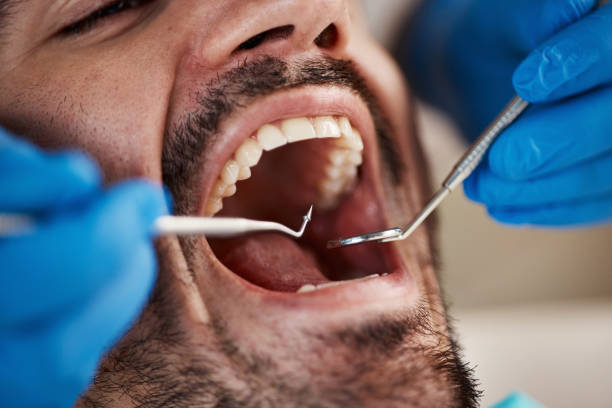 TMJ/TMD Treatment in Cedar Hills, OR